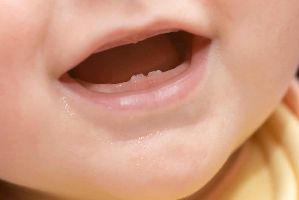 dentizione neonati